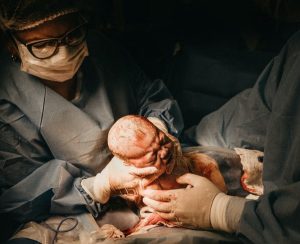 Image of a baby being born. 
