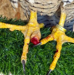Photo of injured talon of Falcon.